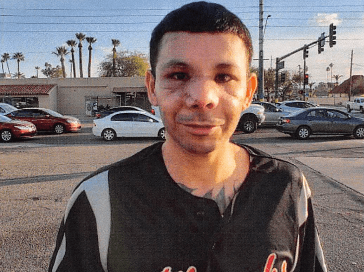 Video: Arizona Police Dog Chewed Half Man’s Face Off. He’s Seeking $2 Million.
