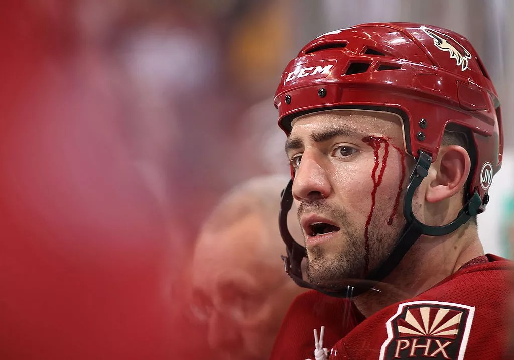 a man in a red hockey jersey and helmet with blood trickling down his face